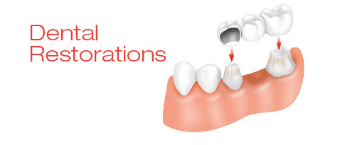 Restorative Dentistry